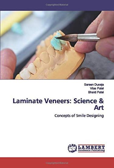 Laminate Veneers: Science & Art
