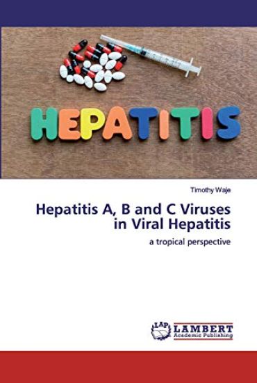 Hepatitis A, B and C Viruses in Viral Hepatitis