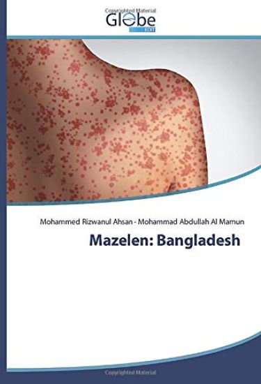Mazelen: Bangladesh
