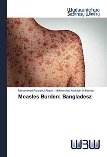 Measles Burden: Bangladesz