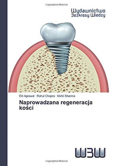 Naprowadzana regeneracja ko¿ci