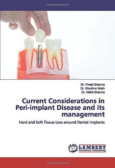 Current Considerations in Peri-implant Disease and its management