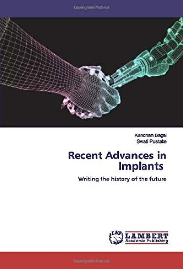 Recent Advances in Implants