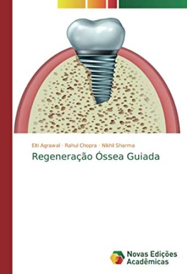 Regeneração Óssea Guiada