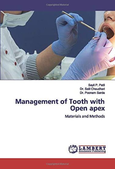 Management of Tooth with Open apex