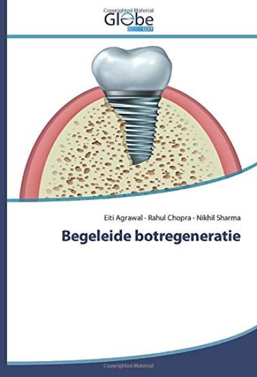 Begeleide botregeneratie