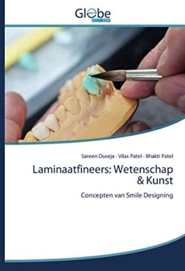 Laminaatfineers: Wetenschap & Kunst