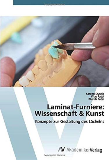 Laminat-Furniere: Wissenschaft & Kunst