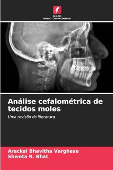 Análise cefalométrica de tecidos moles