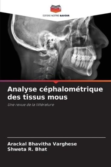 Analyse céphalométrique des tissus mous