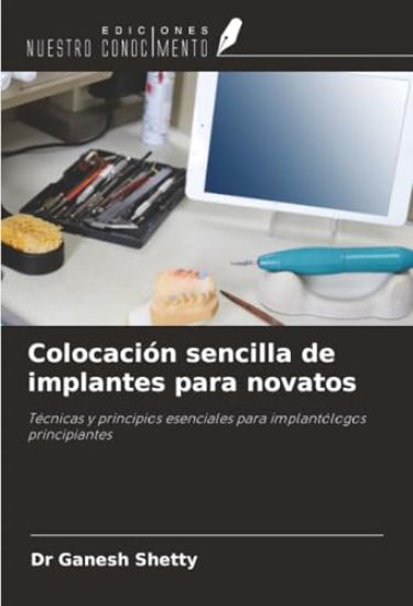Colocación sencilla de implantes para novatos