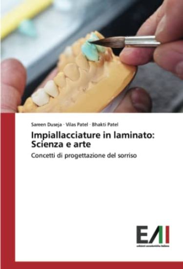Impiallacciature in laminato