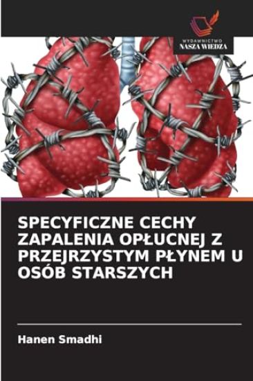 Specyficzne Cechy Zapalenia Oplucnej Z Przejrzystym Plynem U Osób Starszych