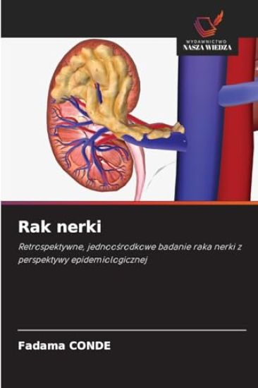Rak nerki