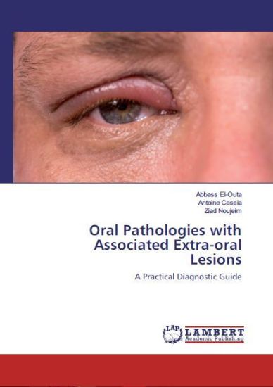 Oral Pathologies with Associated Extra-oral Lesions