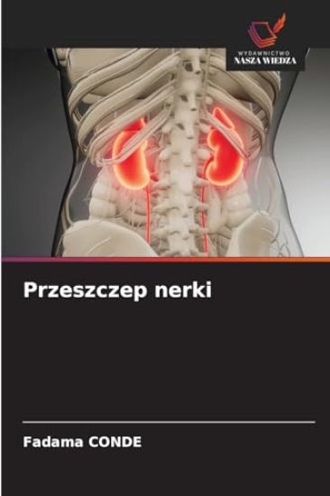 Przeszczep nerki