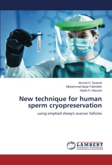 New technique for human sperm cryopreservation