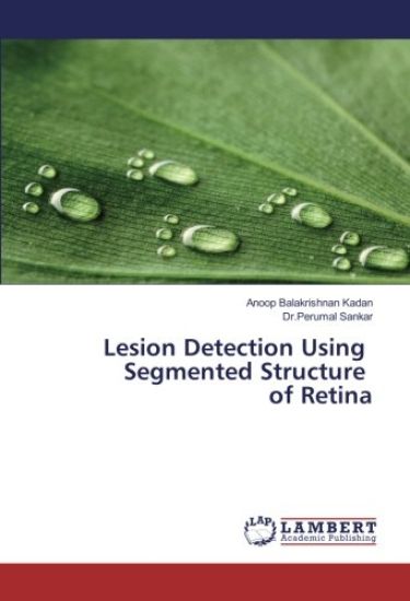 Lesion Detection Using Segmented Structure of Retina