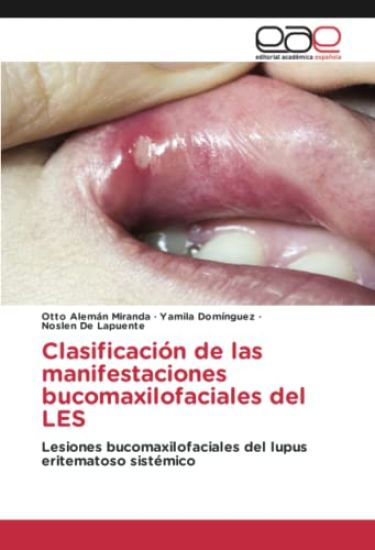 Clasificación de las manifestaciones bucomaxilofaciales del LES
