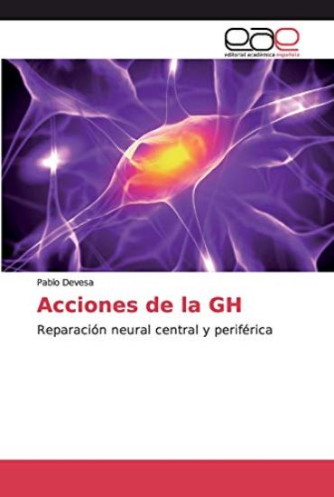 Acciones de la GH