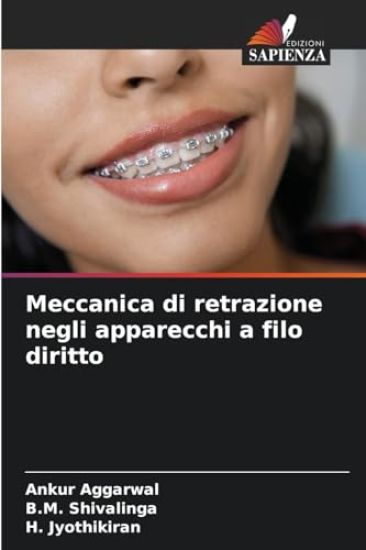 Meccanica di retrazione negli apparecchi a filo diritto