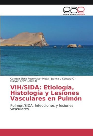 VIH/SIDA: Etiología, Histología y Lesiones Vasculares en Pulmón