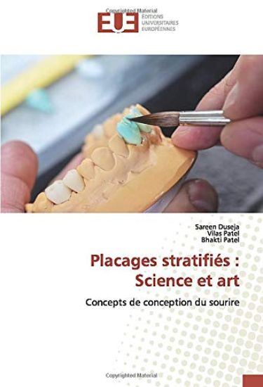 Placages stratifiés : Science et art