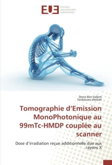 Tomographie d¿Emission MonoPhotonique au 99mTc-HMDP couplée au scanner