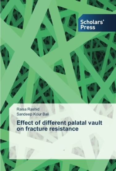 Effect of different palatal vault on fracture resistance
