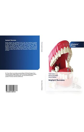 Implant Success