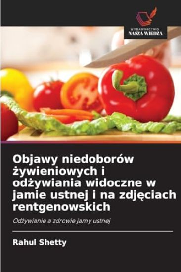 Objawy niedoborów zywieniowych i odzywiania widoczne w jamie ustnej i na zdjeciach rentgenowskich