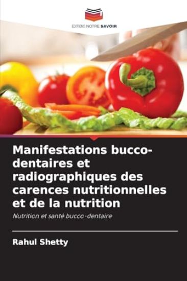 Manifestations bucco-dentaires et radiographiques des carences nutritionnelles et de la nutrition