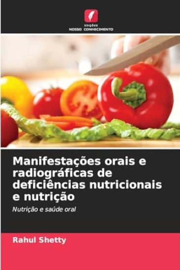 Manifestações orais e radiográficas de deficiências nutricionais e nutrição