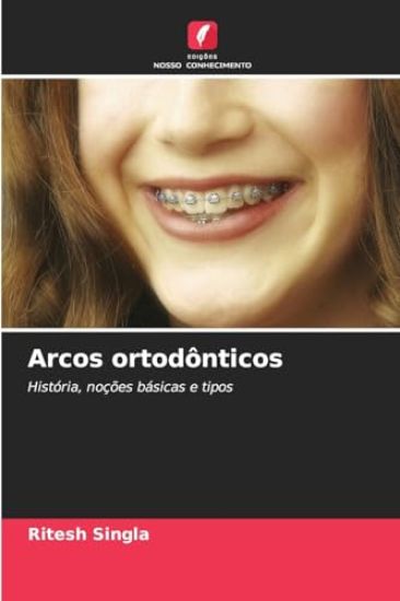 Arcos ortodônticos