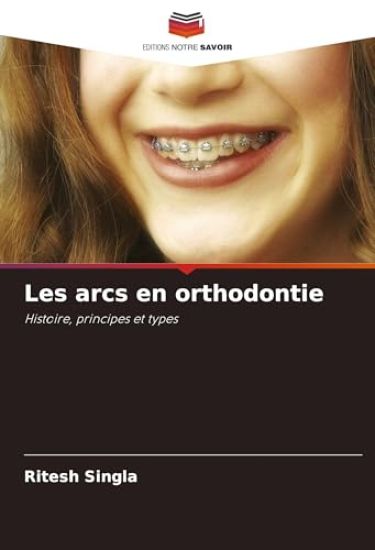 Les arcs en orthodontie