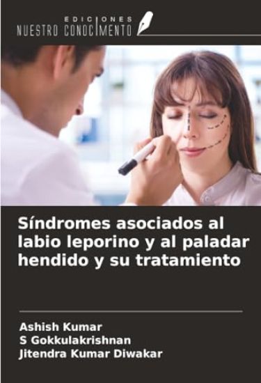Síndromes asociados al labio leporino y al paladar hendido y su tratamiento