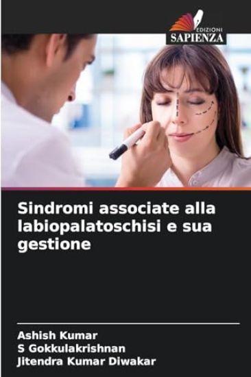 Sindromi associate alla labiopalatoschisi e sua gestione