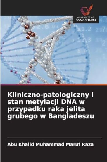 Kliniczno-patologiczny i stan metylacji DNA w przypadku raka jelita grubego w Bangladeszu