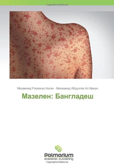 Mazelen: Bangladesh