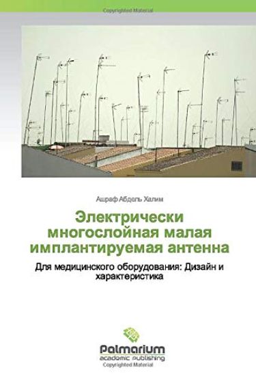 Jelektricheski mnogoslojnaq malaq implantiruemaq antenna