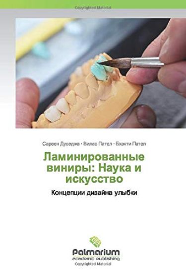 Laminirowannye winiry: Nauka i iskusstwo