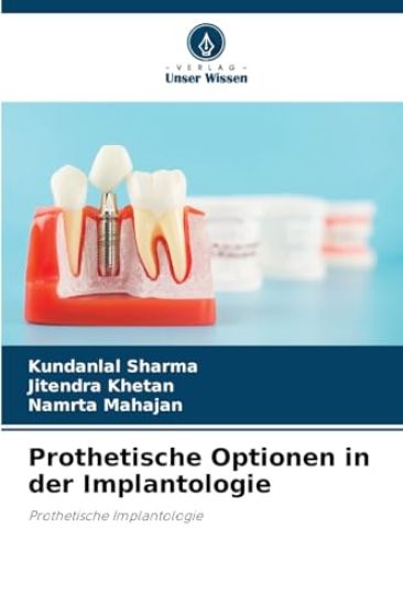 Prothetische Optionen in der Implantologie
