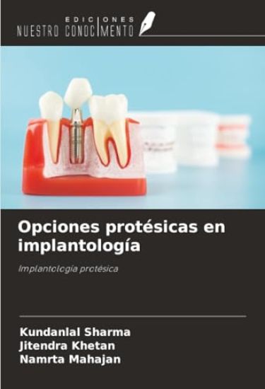 Opciones protésicas en implantología