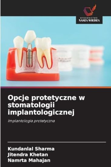 Opcje protetyczne w stomatologii implantologicznej