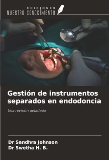 Gestión de instrumentos separados en endodoncia