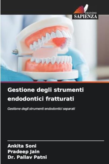 Gestione degli strumenti endodontici fratturati