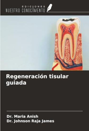 Regeneración tisular guiada