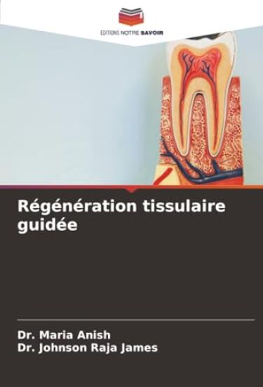 Régénération tissulaire guidée