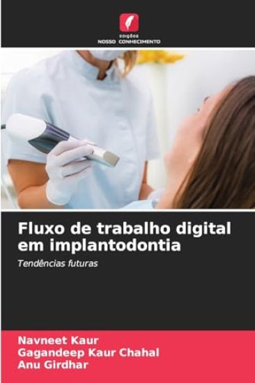 Fluxo de trabalho digital em implantodontia