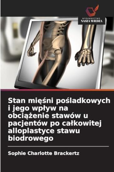 Stan mięśni pośladkowych i jego wplyw na obciążenie stawów u pacjentów po calkowitej alloplastyce stawu biodrowego